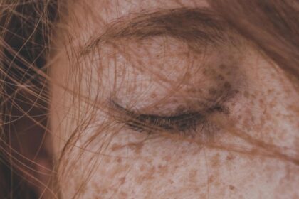 caz iesit din comun intr un spital din romania medicii au extras un vierme de 11 centimetri din pleoapa unei tinere 692d9bc07d5d0