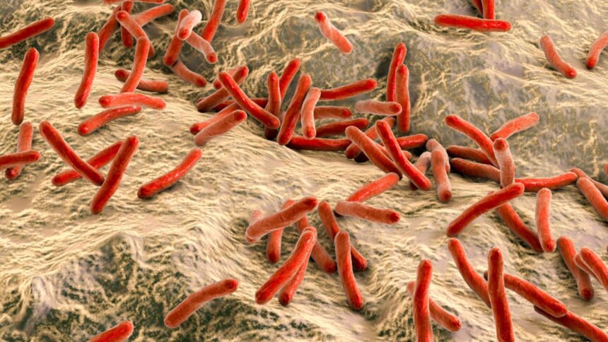 caz rar de lepra confirmat intr o tara din europa autoritatile explica sursa infectarii 693fcf69dce2b