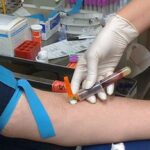 un sofer banuit ca era baut si a dat acordul sa i fie prelevat sange dar fara ac judecatorii au rezolvat dilema condamnandu l la un an de inchisoare 692f970a84fda