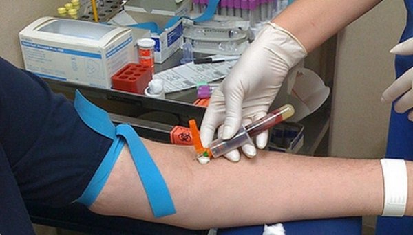 un sofer banuit ca era baut si a dat acordul sa i fie prelevat sange dar fara ac judecatorii au rezolvat dilema condamnandu l la un an de inchisoare 692f970a84fda