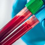 un test de sange revolutionar pentru cancerul pulmonar dezvoltat de cercetatori 6947b1e9ac077