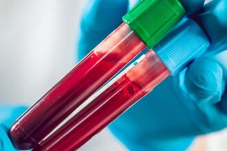 un test de sange revolutionar pentru cancerul pulmonar dezvoltat de cercetatori 6947b1e9ac077