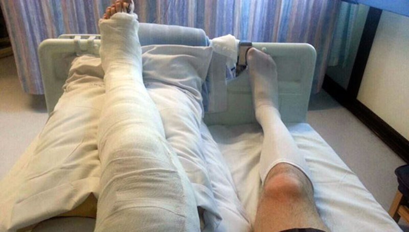 doua sisteme diferite un italian isi rupe piciorul in sua un american isi rupe piciorul in italia cine castiga 6978d03be7efb