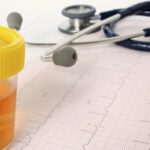 nu stiam ca la voi e interzis in loc sa faca pipi in borcanelul de probe a pus in el apa de la wc ce a patit in instanta un sofer iesean prins drogat la volan 695732112d73d