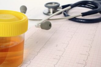 nu stiam ca la voi e interzis in loc sa faca pipi in borcanelul de probe a pus in el apa de la wc ce a patit in instanta un sofer iesean prins drogat la volan 695732112d73d