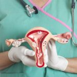 care sunt semnele cancerului de col uterin si cat de des se face testarea prezenta virusului hpv nu inseamna cancer 698c22a833961