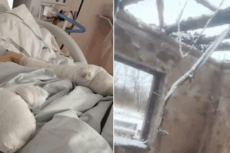 exclusiv un copil cu arsuri grave pe fata si maini expus riscurilor de contaminare micutul este tratat intr o sectie inchisa de corpul de control al ministrului 69950e408486a