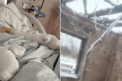 exclusiv un copil cu arsuri grave pe fata si maini expus riscurilor de contaminare micutul este tratat intr o sectie inchisa de corpul de control al ministrului 69950e408486a