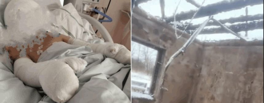 exclusiv un copil cu arsuri grave pe fata si maini expus riscurilor de contaminare micutul este tratat intr o sectie inchisa de corpul de control al ministrului 69950e408486a