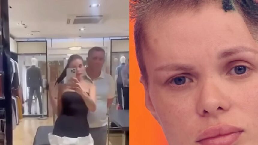 imagini socante cu modelul agresat de iubit tanara de 33 de ani a suferit o interventie pe creier dupa atacul violent 698f8e3912679