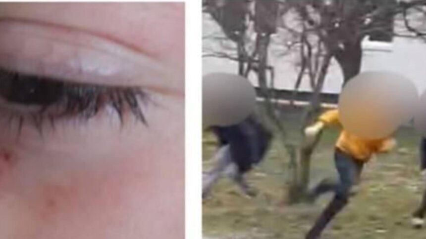 incident grav la o scoala din maramures baiat de 12 ani lovit de doua colege politia a deschis o ancheta 699427fea1abc