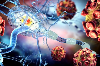 virusul pe care 95 dintre oameni il poarta toata viata si este asociat cu scleroza multipla si unele tipuri de cancer 699cb28587226