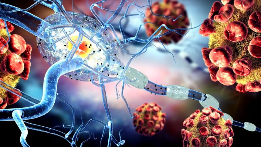 virusul pe care 95 dintre oameni il poarta toata viata si este asociat cu scleroza multipla si unele tipuri de cancer 699cb28587226