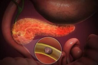 aveti dureri in partea dreapta sus a abdomenului sub coaste medicul chirurg gabriela canschi va ofera un raspuns 69c22221b7239