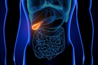 dr gabriela canschi pietrele la fiereo afectiune tacuta cu complicatii zgomotoase 69a915a581f75