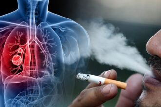 medic primar pneumolog sunt antrenori care le recomanda unor sportivi sa fumeze mai ales inaintea unei competitii 69be65d5a3b46