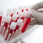 trei copii din iasi transferati la bucuresti dupa confirmarea a doua cazuri de malarie 69c17ce2ebf6d 2