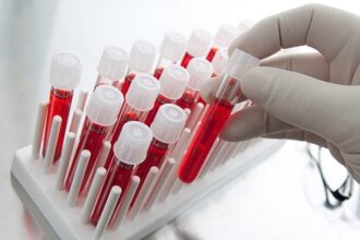 trei copii din iasi transferati la bucuresti dupa confirmarea a doua cazuri de malarie 69c17ce2ebf6d 2