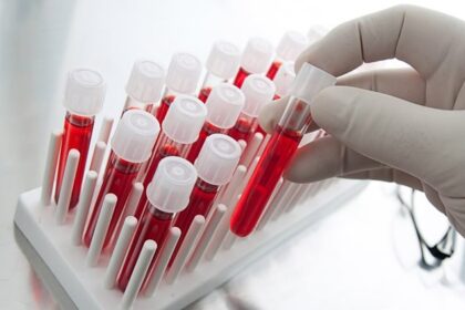 trei copii din iasi transferati la bucuresti dupa confirmarea a doua cazuri de malarie 69c17ce2ebf6d 2