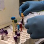 zece cazuri de malarie la iasi in ultimii ani iar un muncitor ce lucra in africa a facut de trei ori boala atentie infectia poate fi fatala ce sfaturi ne dau specialistii ieseni 69c33b869137f