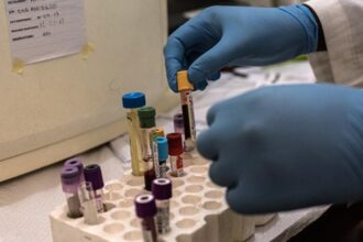 zece cazuri de malarie la iasi in ultimii ani iar un muncitor ce lucra in africa a facut de trei ori boala atentie infectia poate fi fatala ce sfaturi ne dau specialistii ieseni 69c33b869137f