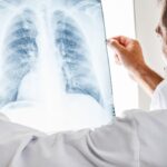 adultii care nu se casatoresc risc semnificativ de cancer studiu care a analizat peste 4 milioane de cazuri 69d9e4290659e