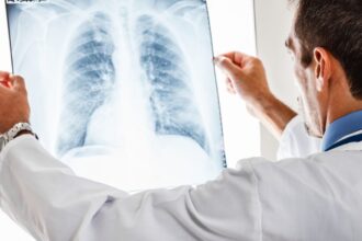 adultii care nu se casatoresc risc semnificativ de cancer studiu care a analizat peste 4 milioane de cazuri 69d9e4290659e