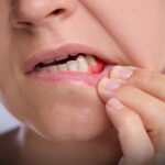 de ce reabilitarea totala trebuie privita ca un nou inceput nu doar ca o lucrare dentara p 69d3ab8cdd07d