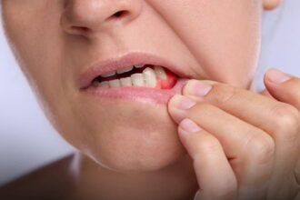 de ce reabilitarea totala trebuie privita ca un nou inceput nu doar ca o lucrare dentara p 69d3ab8cdd07d