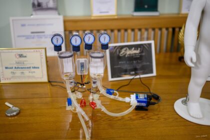 la iasi bate cea mai mica inima artificiala din lume prototipul cat o minge de golf ar trebui sa coste sub 50 000 de euro la productia in masa 69da7b555f4b3