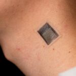 un plasture activat termic poate distruge celulele de melanom fara interventie chirurgicala 69cf5ba75057a