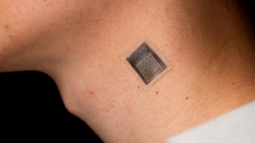 un plasture activat termic poate distruge celulele de melanom fara interventie chirurgicala 69cf5ba75057a