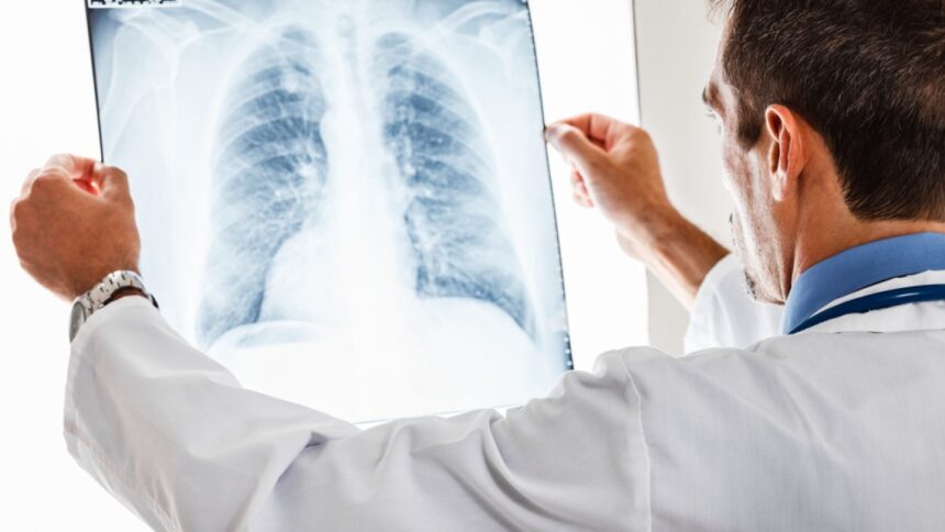 nature ar putea o pastila sa previna cel mai mortal tip de cancer din lume 6a17d3a3dcb05